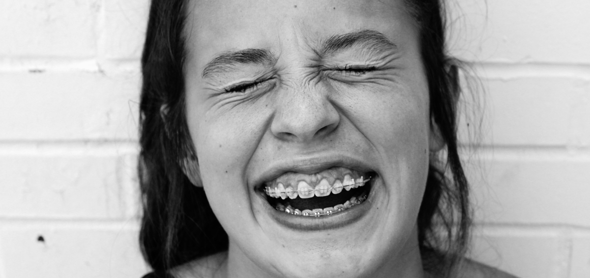 Все, что нужно знать о брекетах: 7 вопросов стоматологу