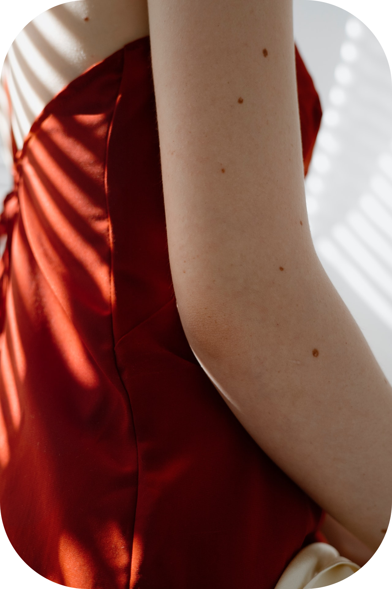 Меланома: всё, что важно знать (фото 4)