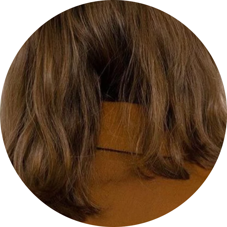 Дайджест: выпадение волос и как его остановить (фото 6)