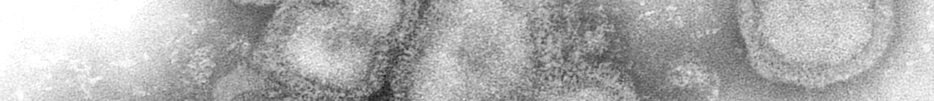 Осенняя аллергия: 5 вопросов эксперту (фото 3)