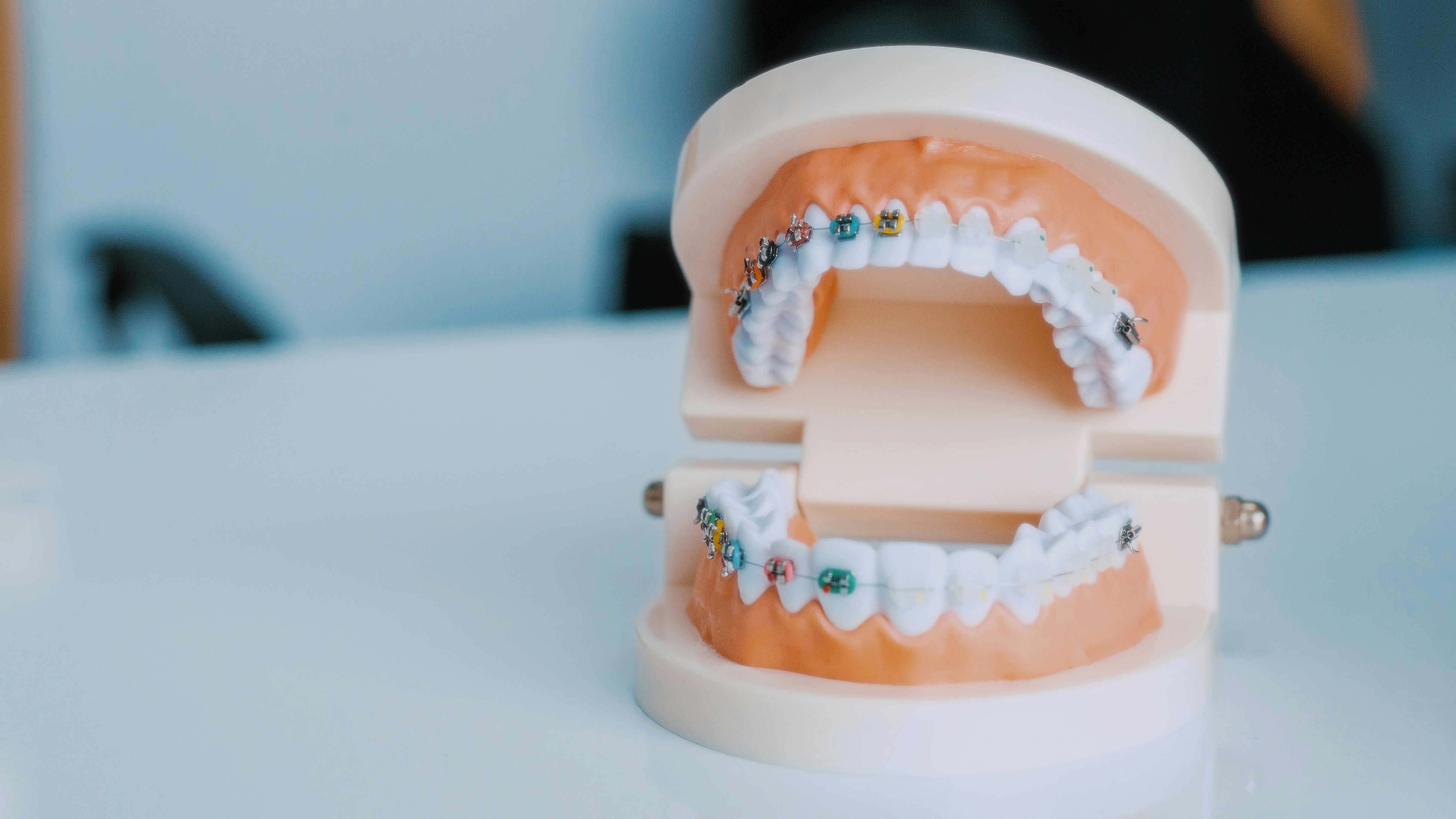 Все, что нужно знать о брекетах: 7 вопросов стоматологу (фото 3)