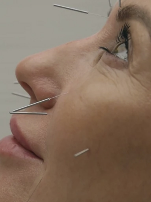 Какие косметологические процедуры можно делать летом: бьюти-дайджест BURO. (фото 14)