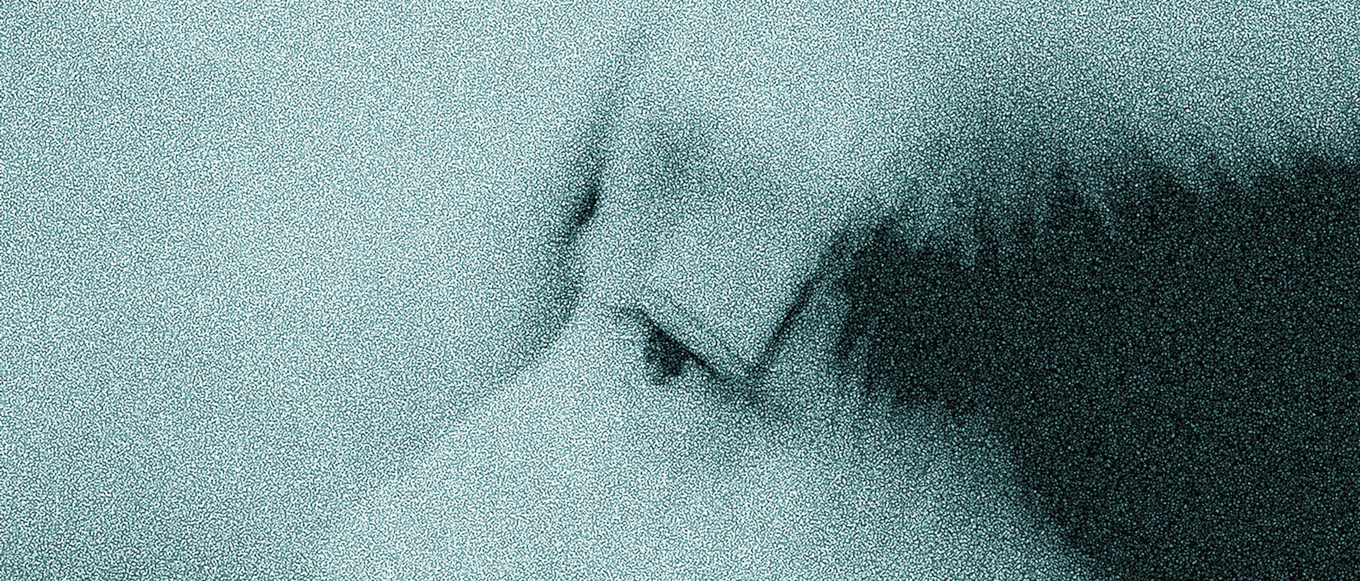 Как защитить глаза в холодное время? Отвечает офтальмолог (фото 3)