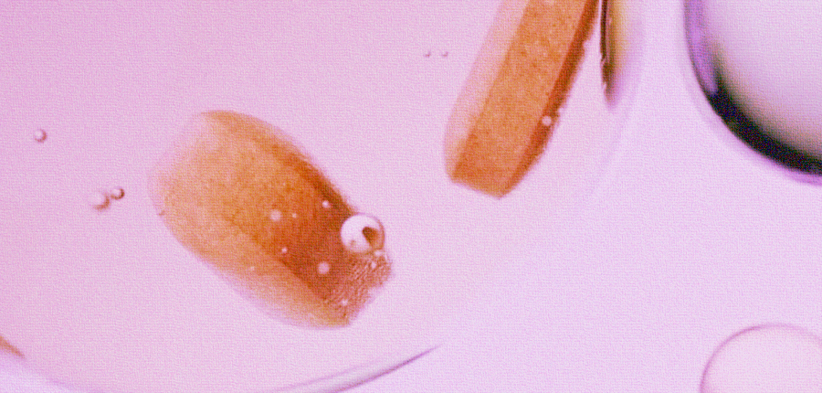 Ферритин и не только: какие миркоэлементы стоит проверить женщинам на чекапе? Отвечает эксперт (фото 3)