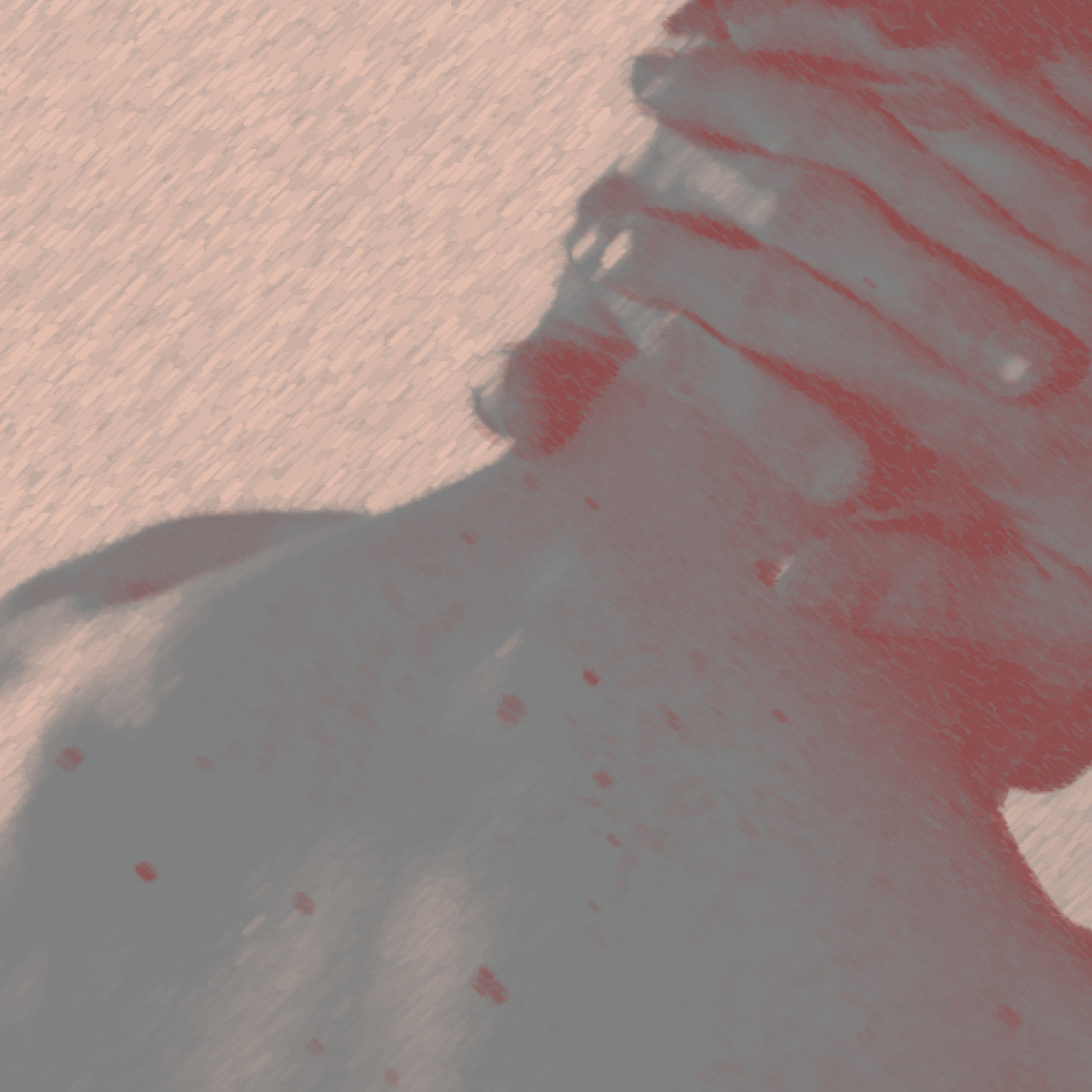 Акне ниже шеи: как избавиться от воспалений на теле? Отвечает эксперт