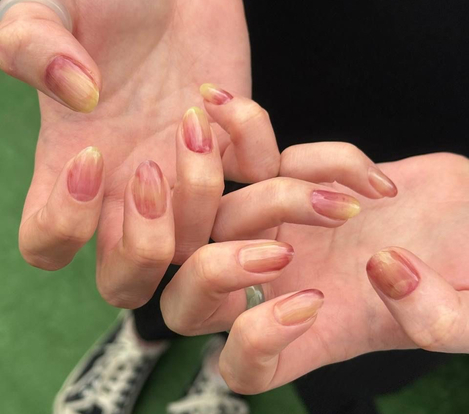 Глянцевые, «надутые» и «мыльные» ногти: главные тренды маникюра на лето 2025 (фото 20)