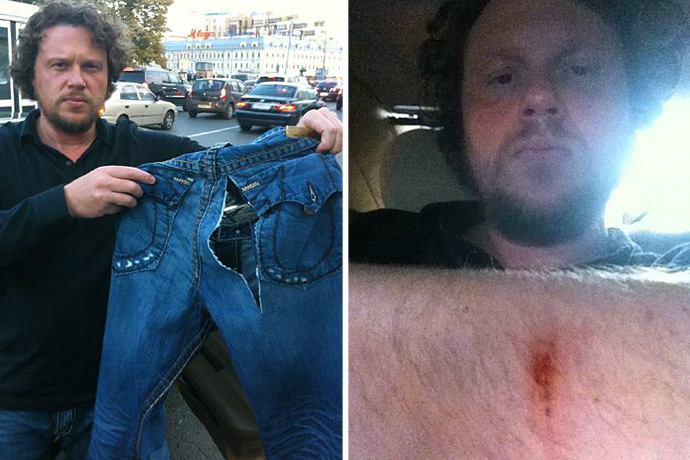 Полонский спровоцировал драку в эфире (фото 1)