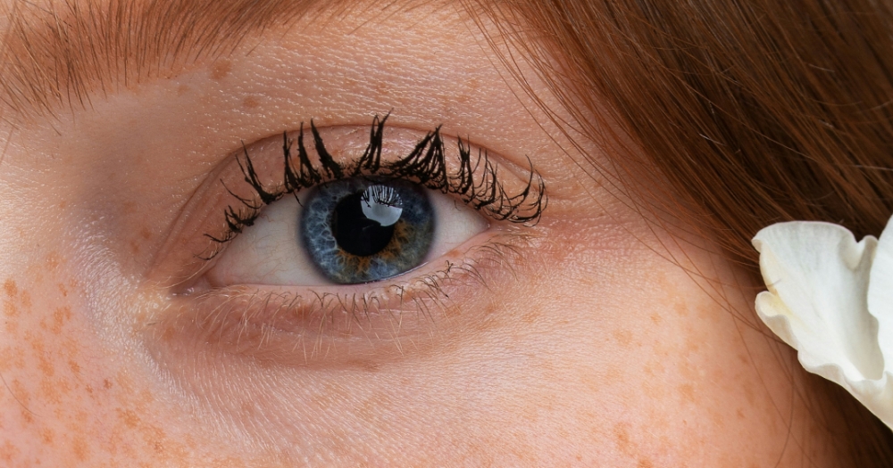 Веснушки и пигментация: почему появляются и как избавиться? Отвечает эксперт