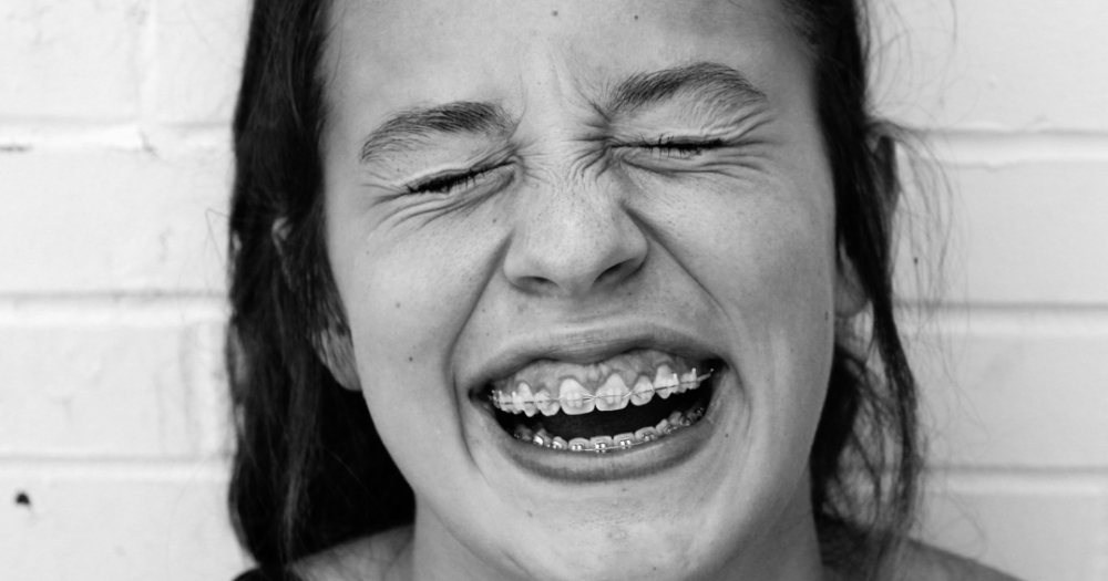 Все, что нужно знать о брекетах: 7 вопросов стоматологу