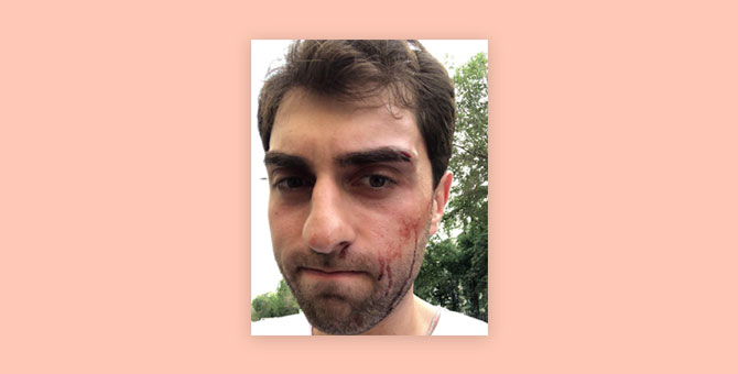 Охранники московского клуба «Моно» напали на посетителей