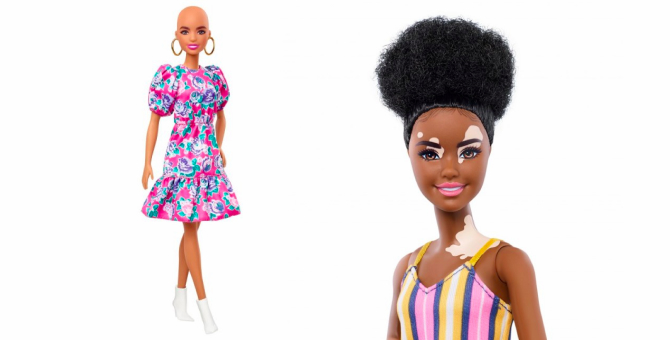 Mattel выпустила кукол Барби с витилиго и алопецией