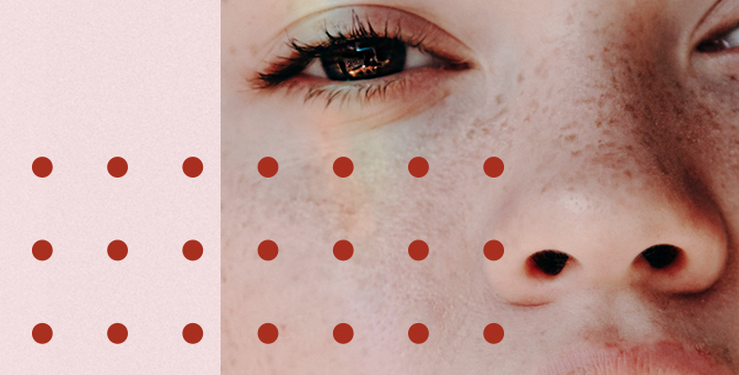 Акне: причины и диагностика