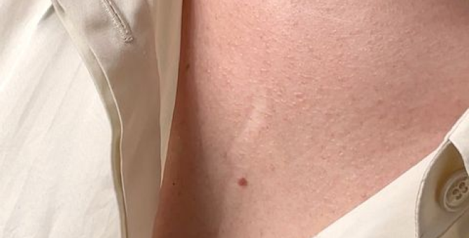 Ресейл-платформа The Cultt представила видеопроект о восприятии шрамов и дефектов