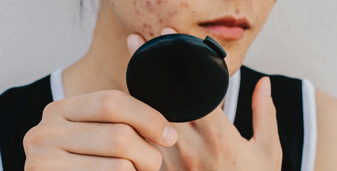 Google работает над приложением, которое будет диагностировать кожные заболевания