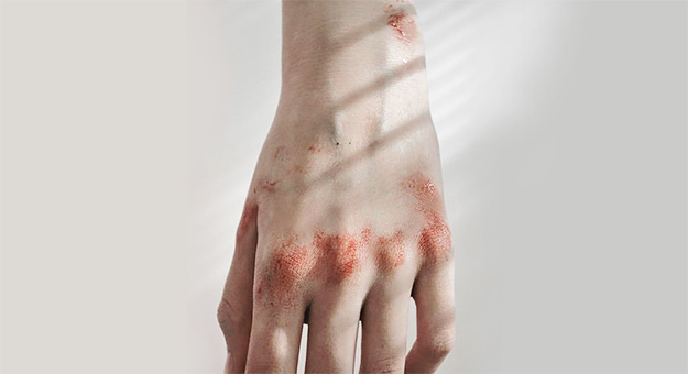 Госдума отменила уголовное наказание за побои в семье