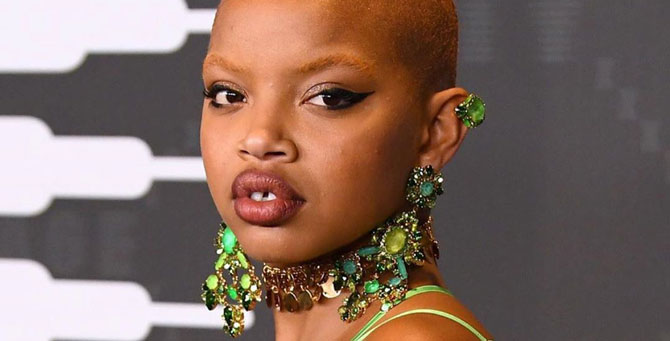 У модели Слик Вудс, музы Рианны, обнаружен рак