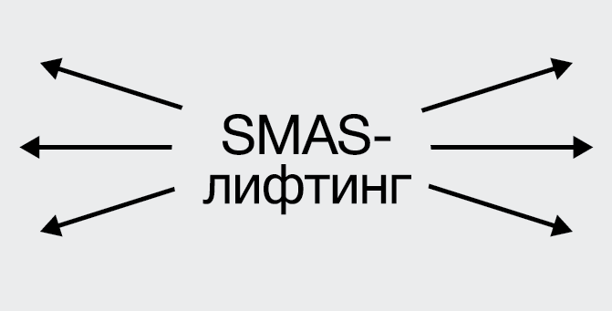 С натяжкой: как работает SMAS-лифтинг и нужен ли он вам