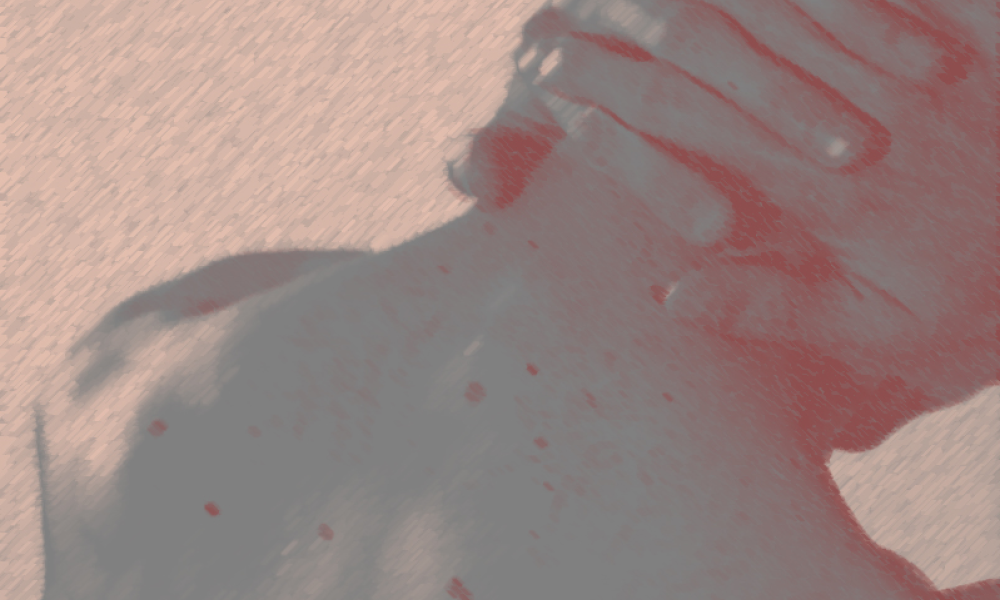 Акне ниже шеи: как избавиться от воспалений на теле? Отвечает эксперт