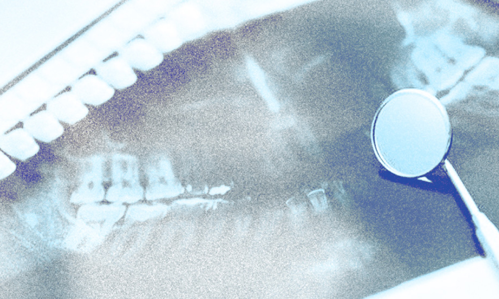 Я только спросить: как работает лазерное лечение десен и почему стоит выбрать именно его?