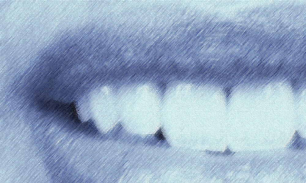 Я только спросить: что такое бруксизм и как перестать скрежетать зубами?