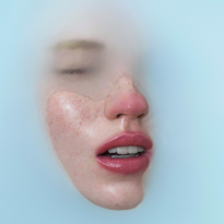 На игле: 9 вопросов про ботокс, которые волнуют всех