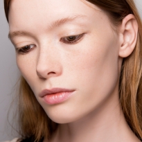 Почему после солнца усиливаются воспаления и как с ними быть