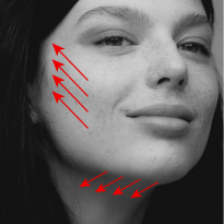 Мнение эксперта о популярной процедуре — Ulthera-терапия