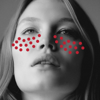 Безинъекционная мезотерапия: мнение эксперта о популярной процедуре