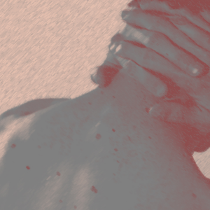 Акне ниже шеи: как избавиться от воспалений на теле? Отвечает эксперт