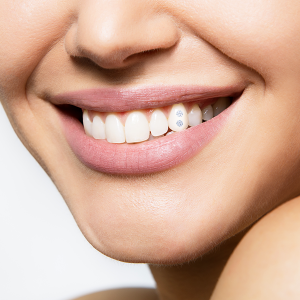 У Беллы Хадид бриллианты в зубах — насколько безопасен тренд из нулевых?