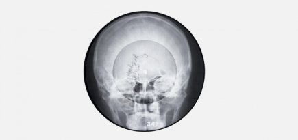 Все о выставке «Музыка на костях» в «Гараже»