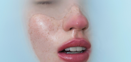 На игле: 9 вопросов про ботокс, которые волнуют всех