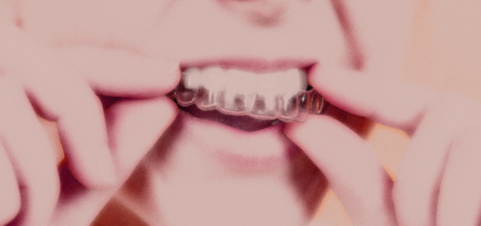 От кап до брекетов: как выбрать путь к идеальной улыбке? Отвечает стоматолог