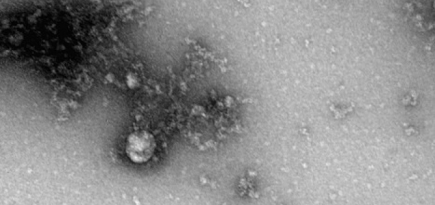 Роспотребнадзор показал первый в мире снимок британского штамма COVID-19