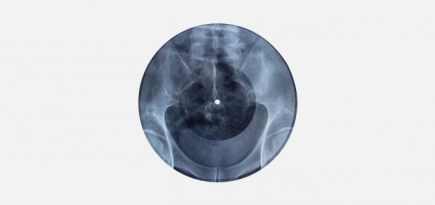 Участники Massive Attack записали музыку на рентгеновской плёнке