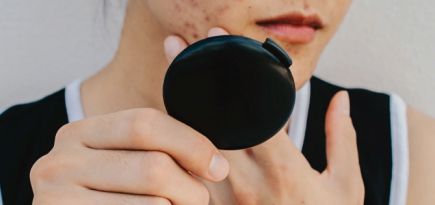 Google работает над приложением, которое будет диагностировать кожные заболевания