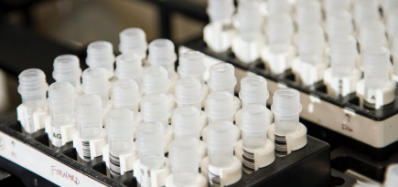 Ферритин: что о нем нужно знать