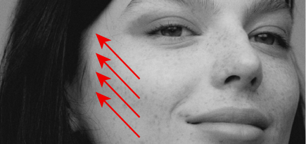 Мнение эксперта о популярной процедуре — Ulthera-терапия