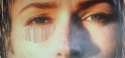 UltraFit, Heleo4 и другие новые процедуры и технологии