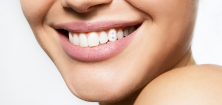 У Беллы Хадид бриллианты в зубах — насколько безопасен тренд из нулевых?