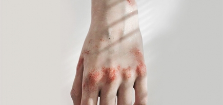 Госдума отменила уголовное наказание за побои в семье