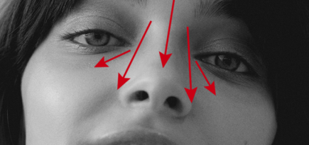 Мнение эксперта о популярной процедуре: безоперационная ринопластика