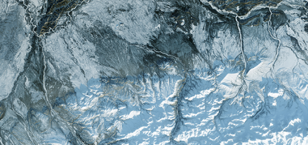 Все замерло: когда колоть ботокс и может ли он навредить