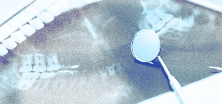 Я только спросить: как работает лазерное лечение десен и почему стоит выбрать именно его?