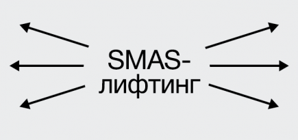 С натяжкой: как работает SMAS-лифтинг и нужен ли он вам