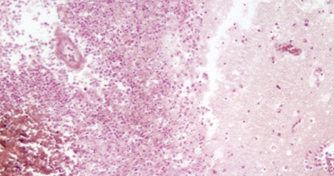 Ученые ускорили работу мозга с помощью магнитов