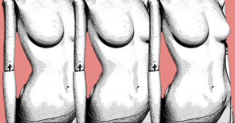 Тренировки, хирургия, аппаратные процедуры: как избавиться от диастаза? Отвечают специалисты