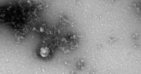 Роспотребнадзор показал первый в мире снимок британского штамма COVID-19