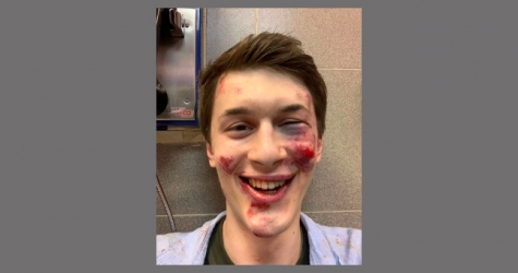 В Москве был избит ведущий «Эха Москвы» Егор Жуков