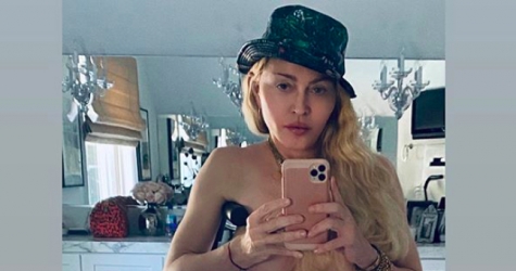 Мадонна опубликовала селфи с костылем и топлес